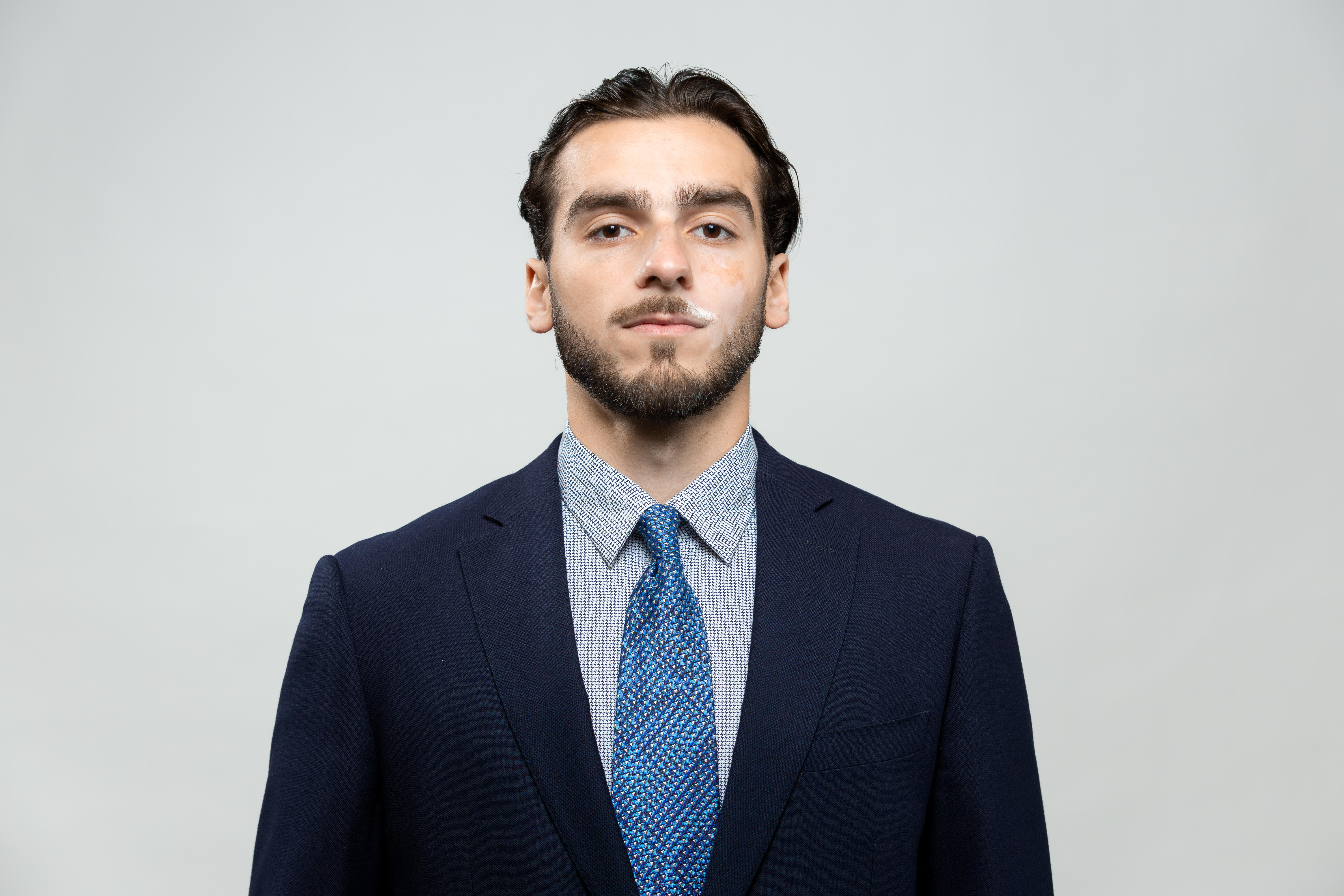 Akhmed Malsagov